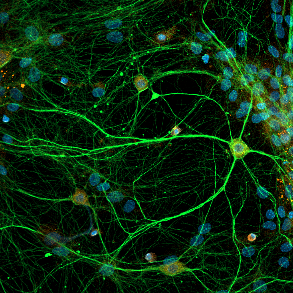 Нейроны, астроциты и ядра